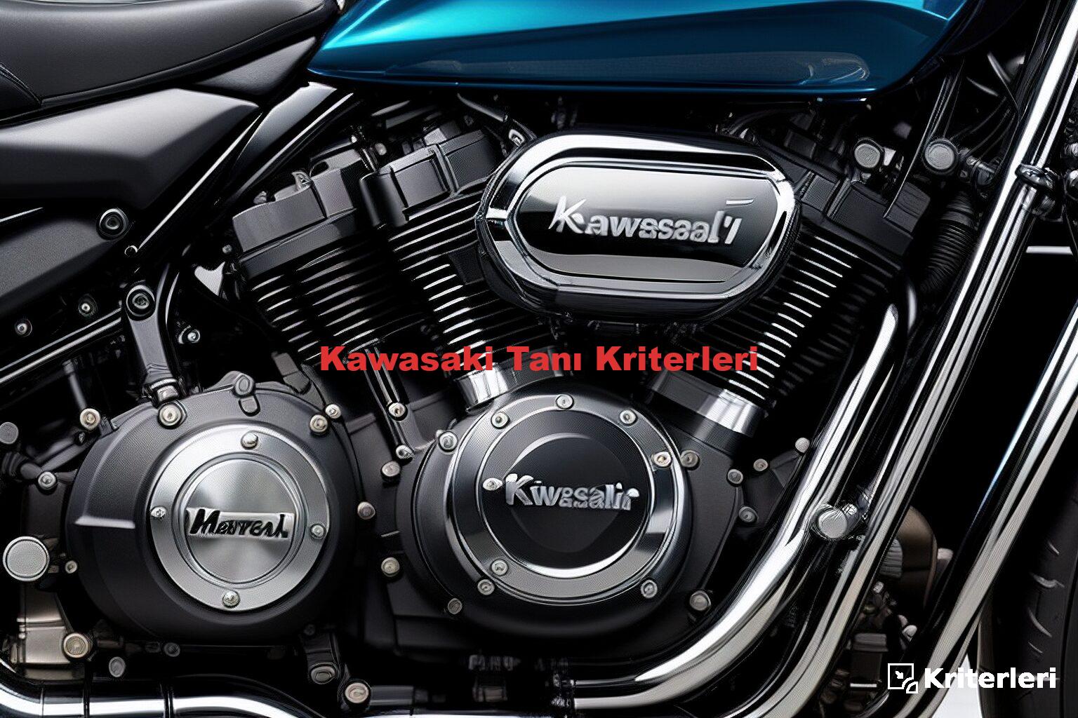 Kawasaki Tanı Kriterleri