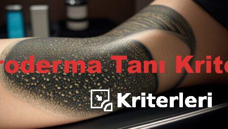 Skleroderma Tanı Kriterleri
