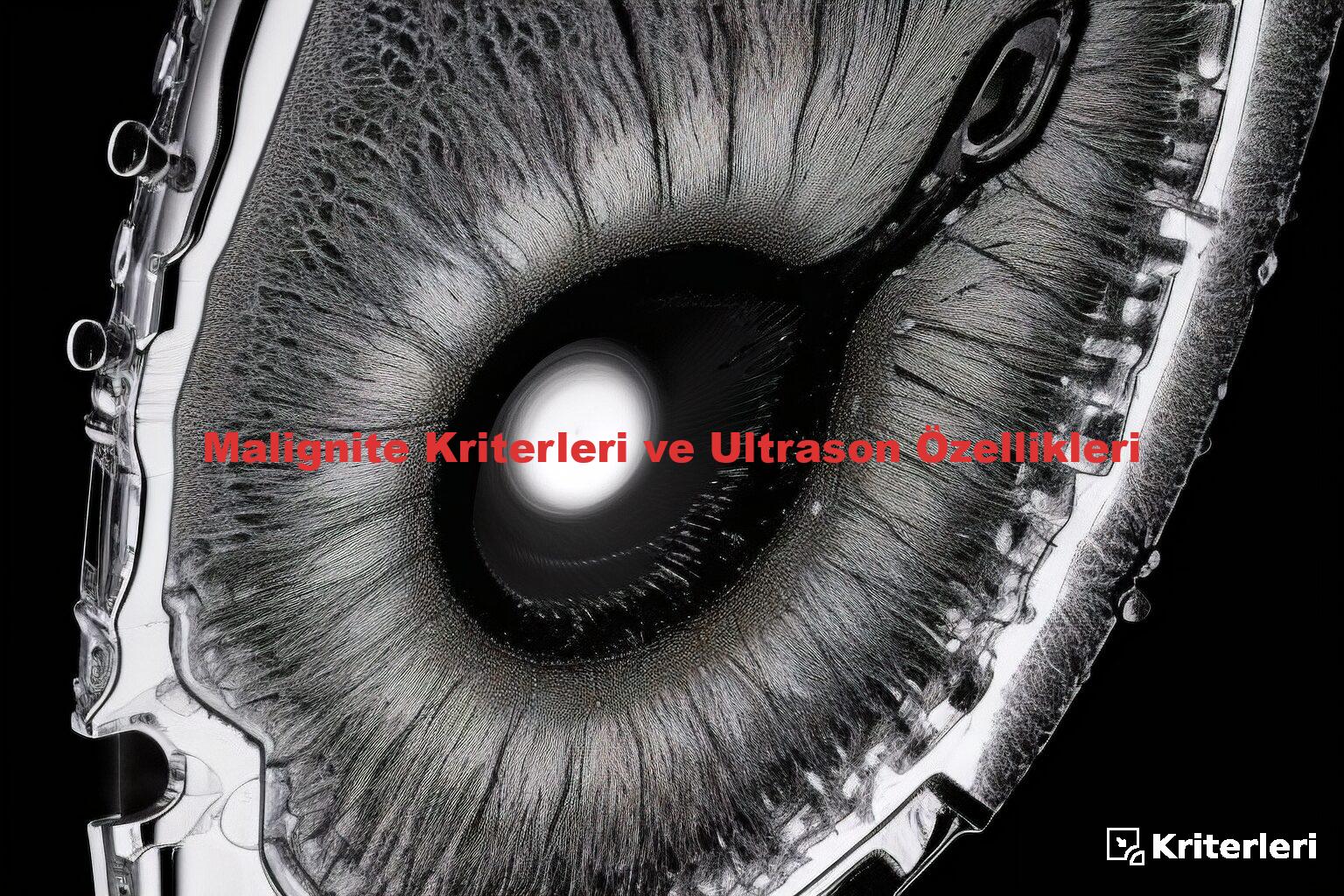 Malignite Kriterleri ve Ultrason Özellikleri