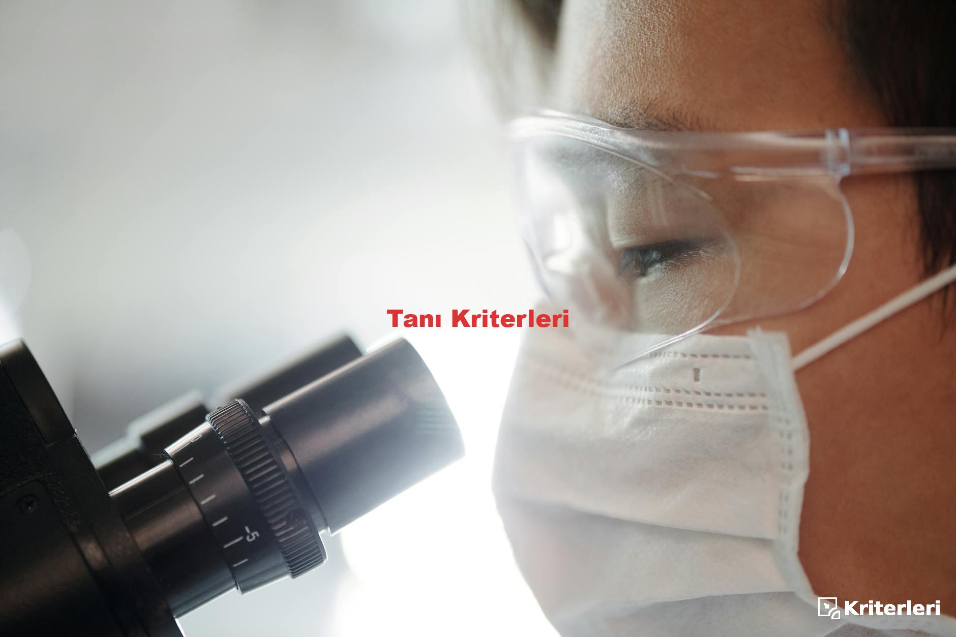 Tanı Kriterleri